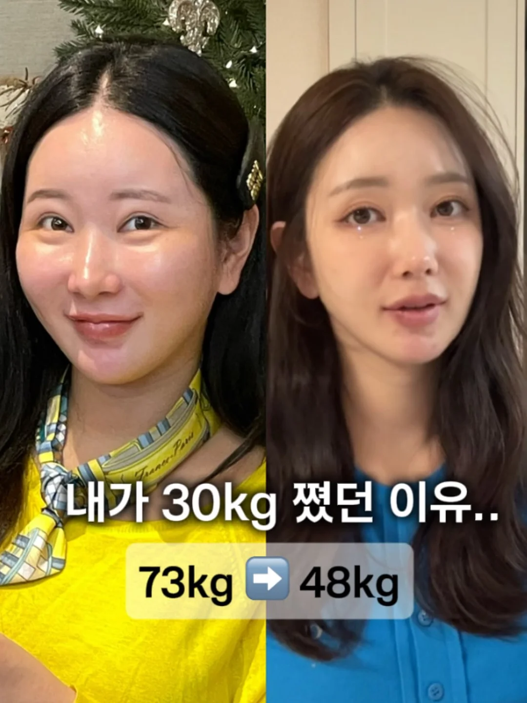셀렉롱셔츠 1
