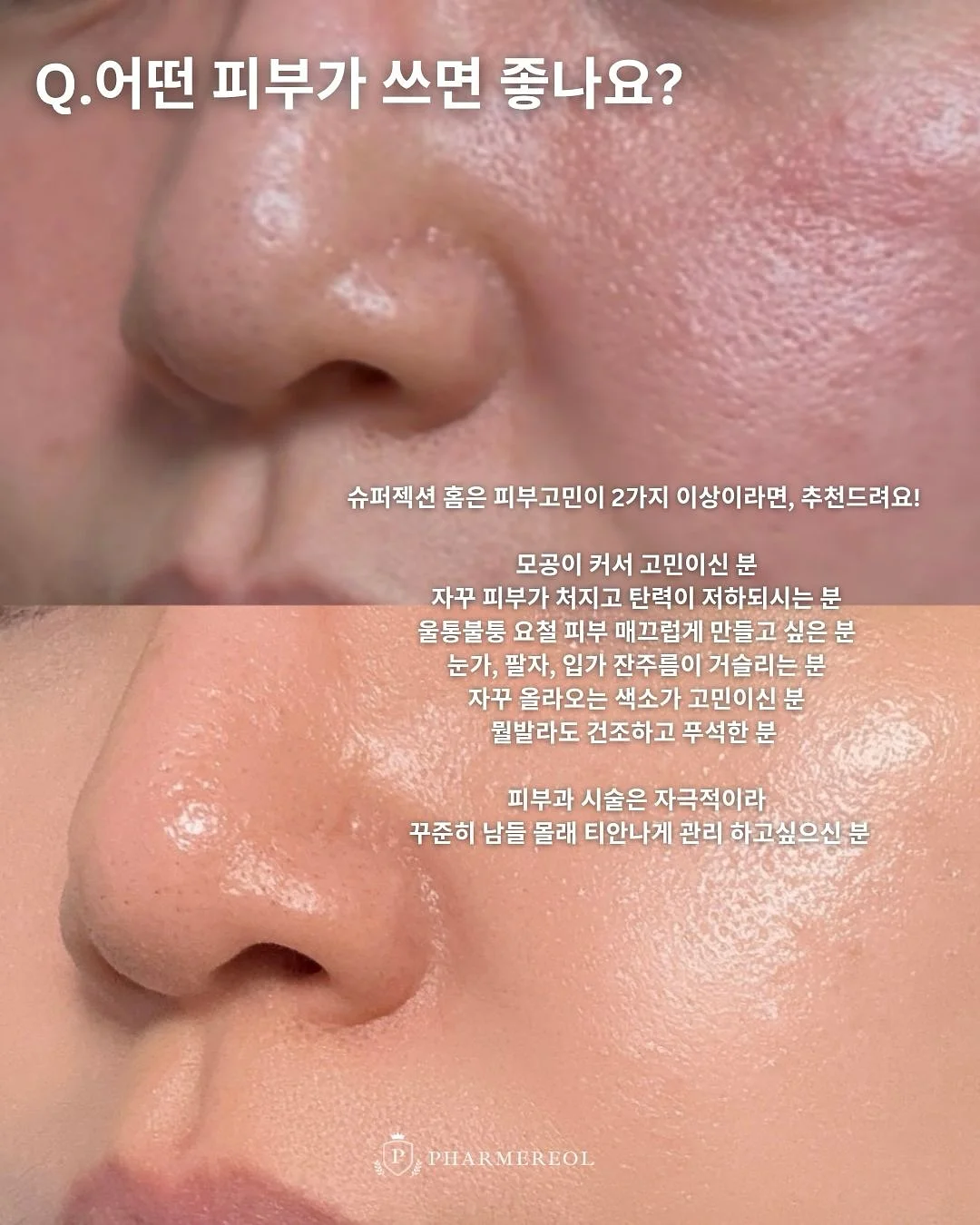 로미엘 오프숄더 도트 블라우스 2