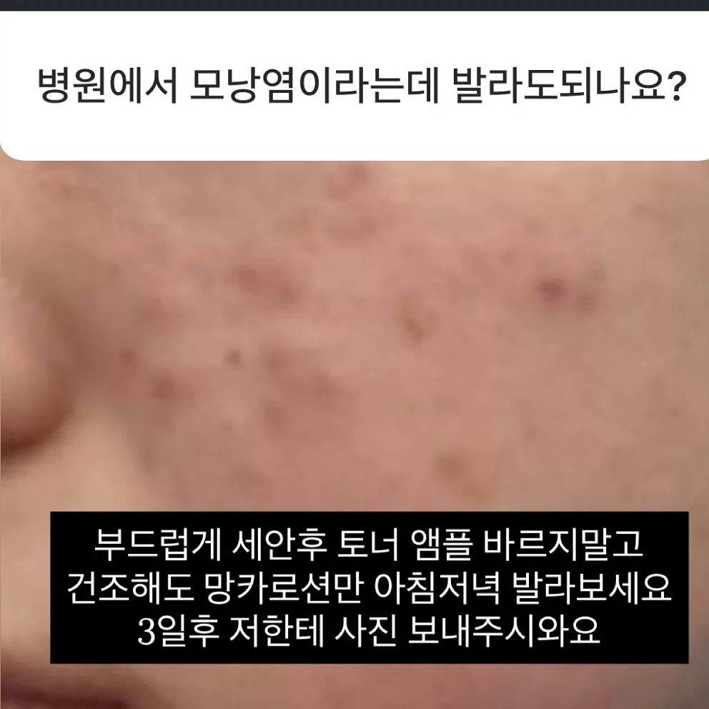 자석젤 그라 12