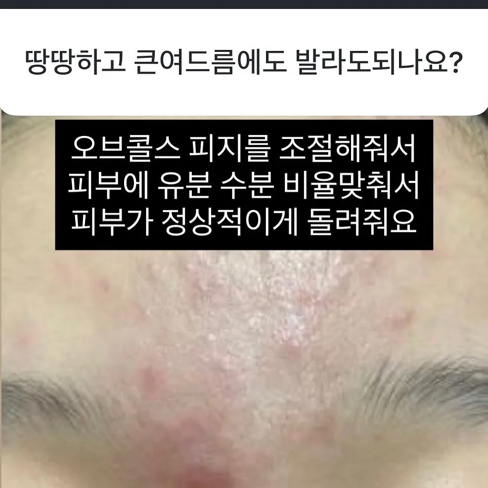 자석젤 그라 13