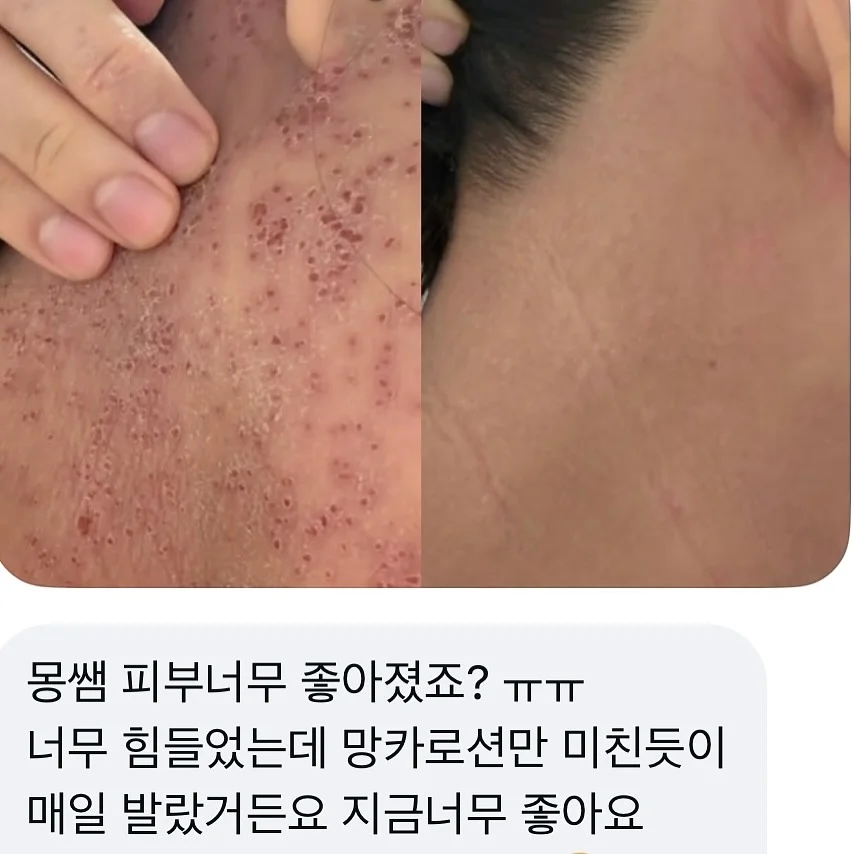 자석젤 그라 2