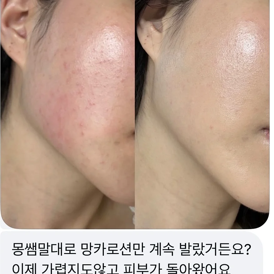 자석젤 그라 3