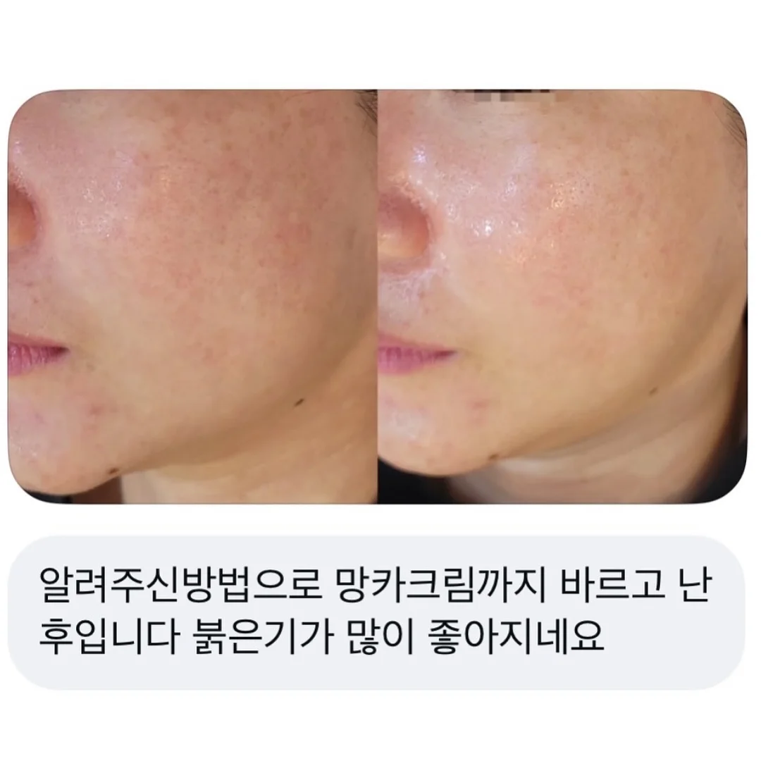 자석젤 그라 5