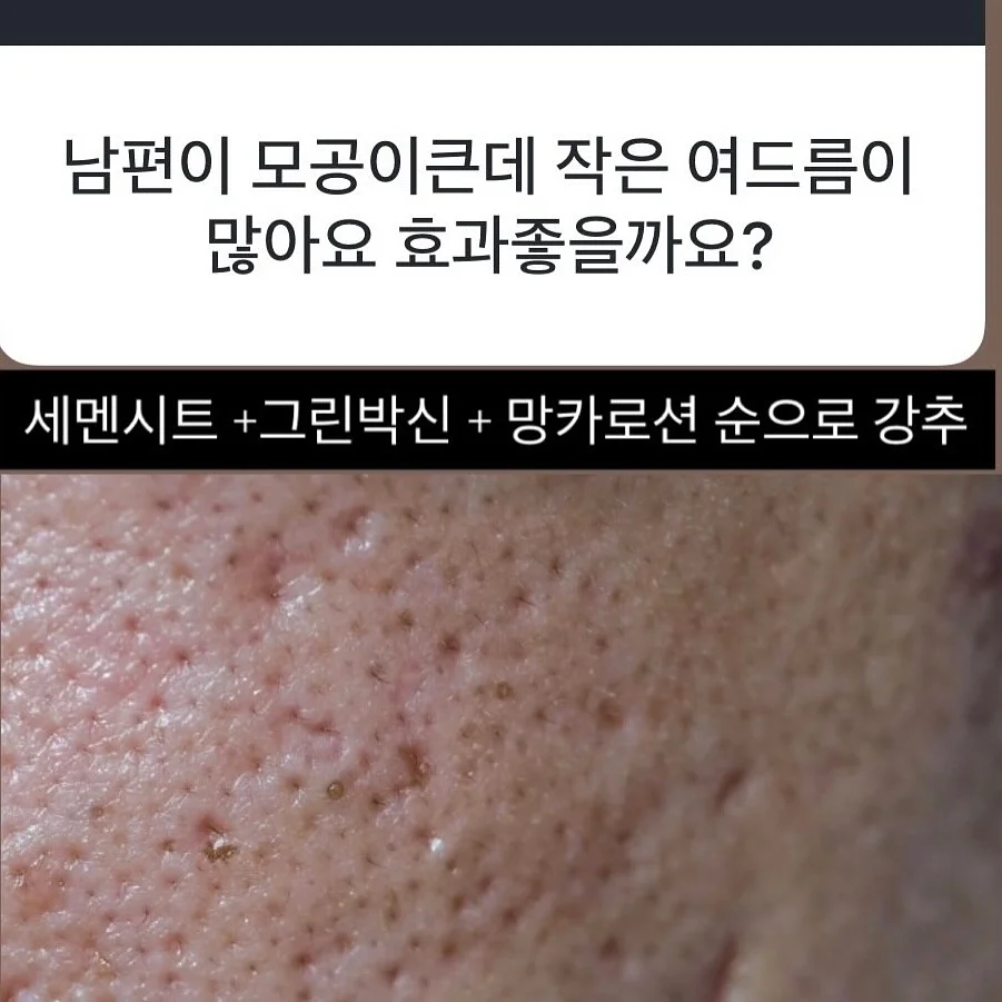 자석젤 그라 6
