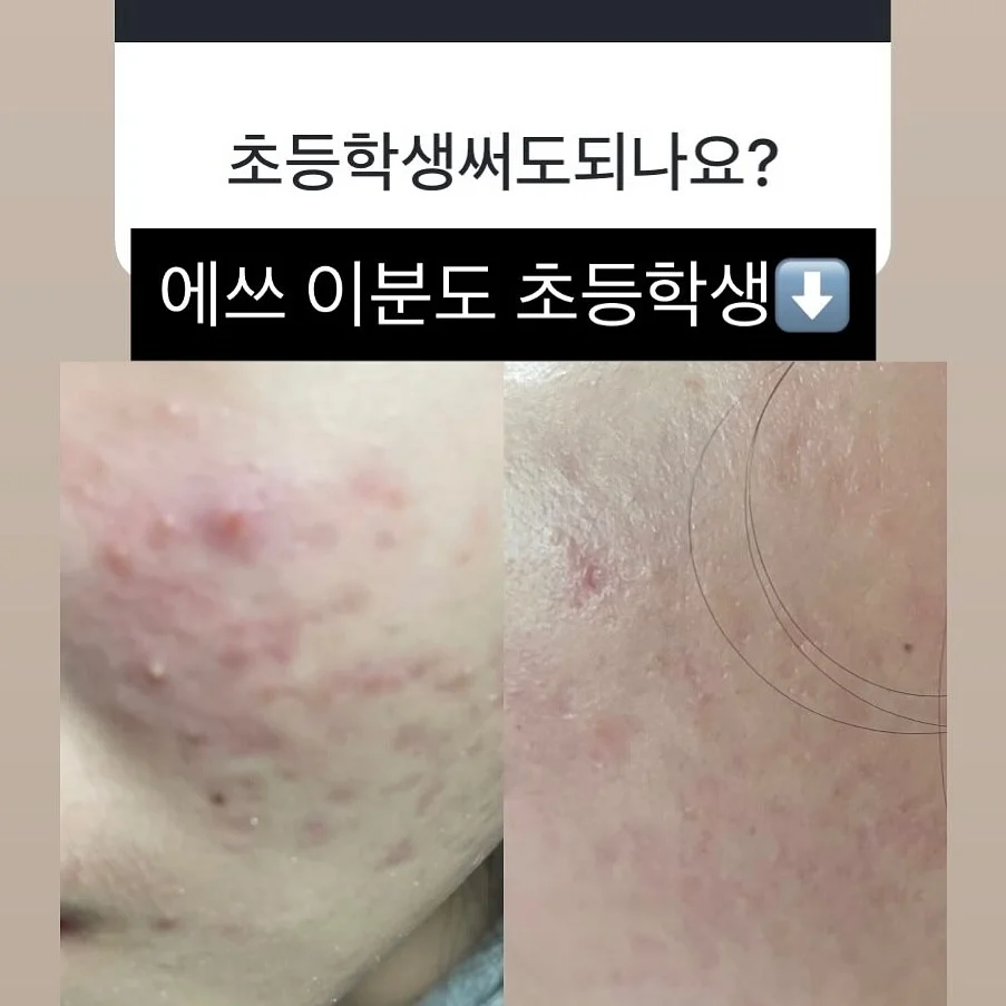 자석젤 그라 7