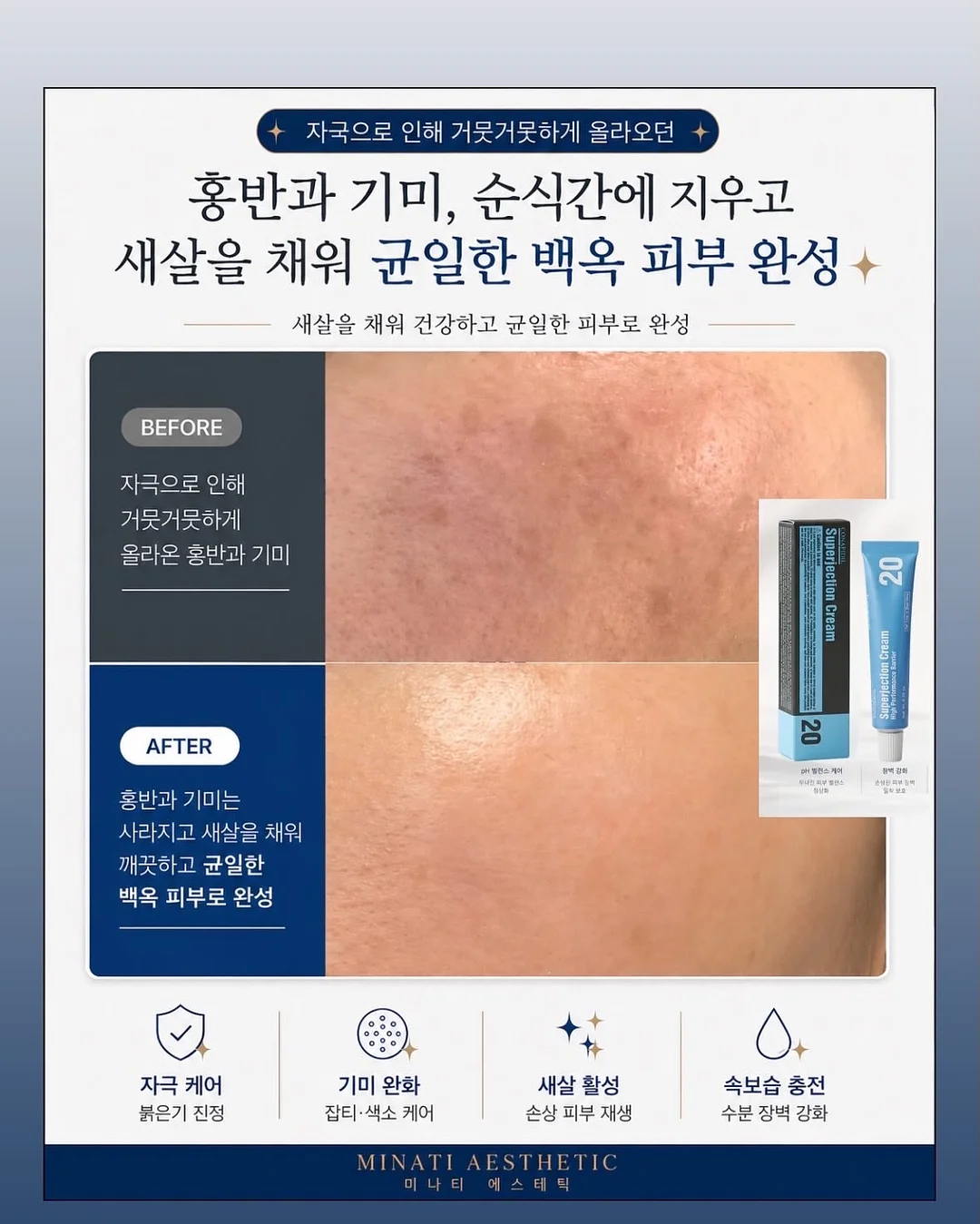 차예련 라면 냄비 9
