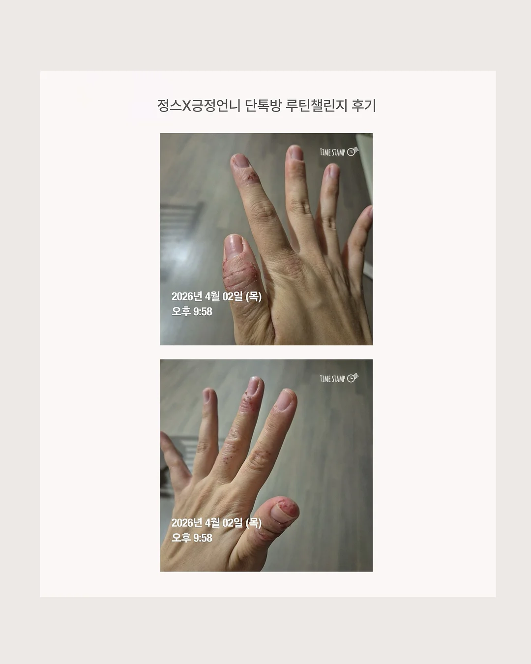 병뚜껑 숫자 맞추기 놀이 도안 11