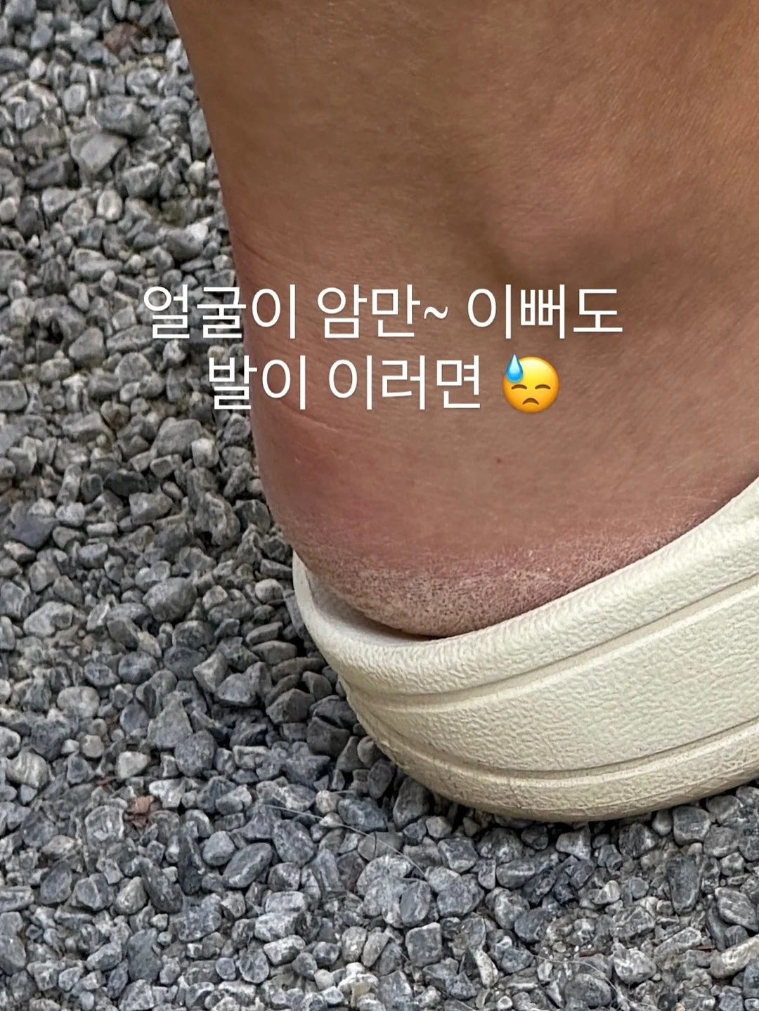 썸머 드레스 프린트 원피스 2