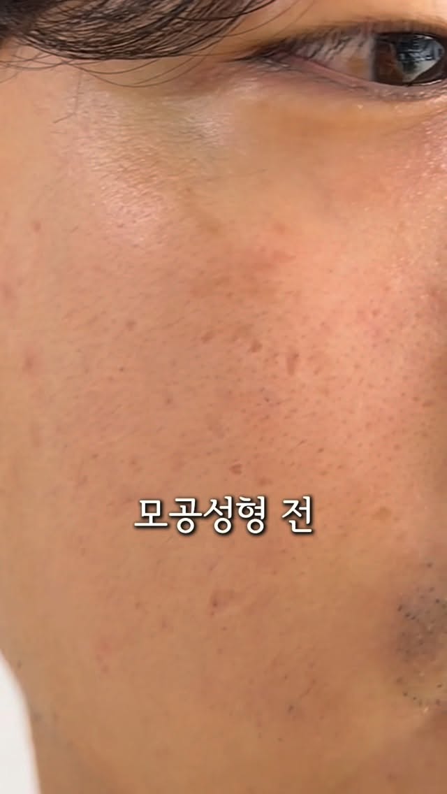 피부 실기 시험 기준