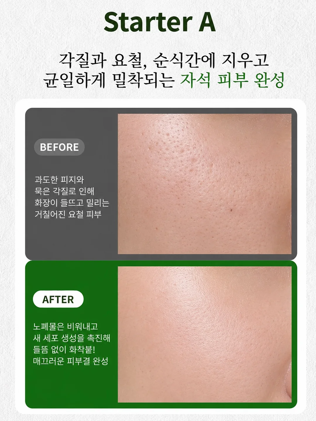 피부미용업 창업 및 운영 프로그램 13