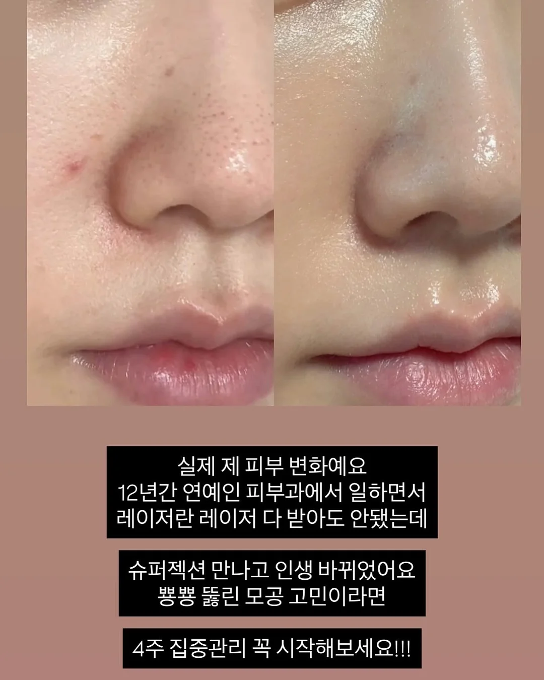 아디다스 트레포일 3S 반팔티 5
