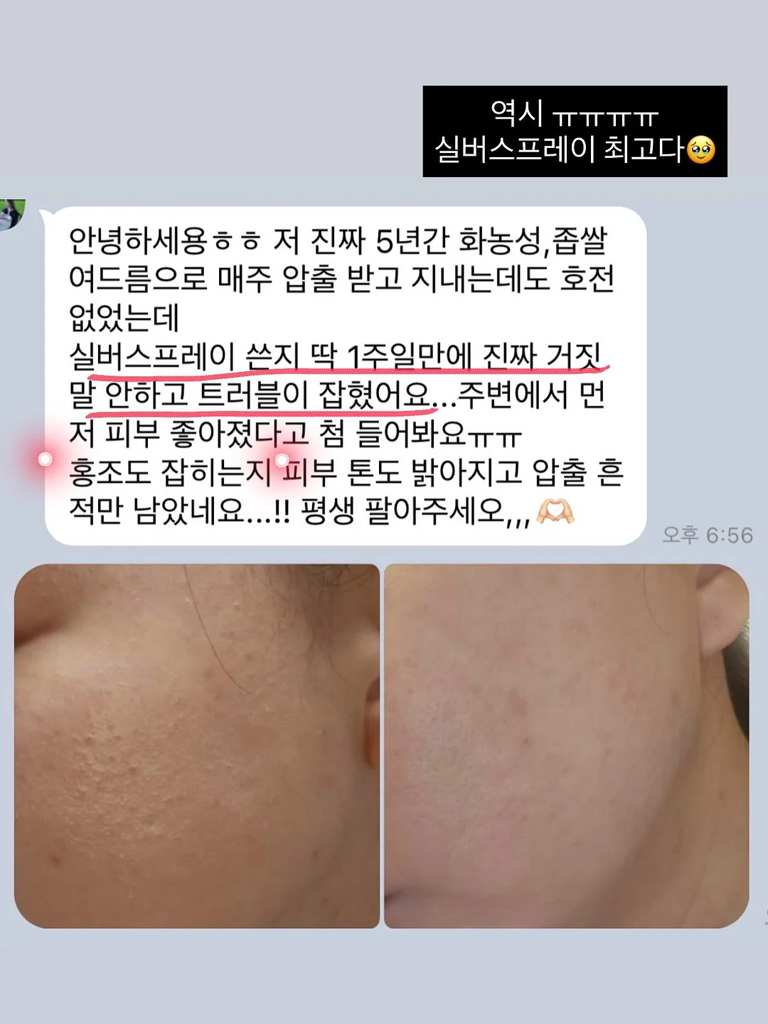 아토 송편 세트 6