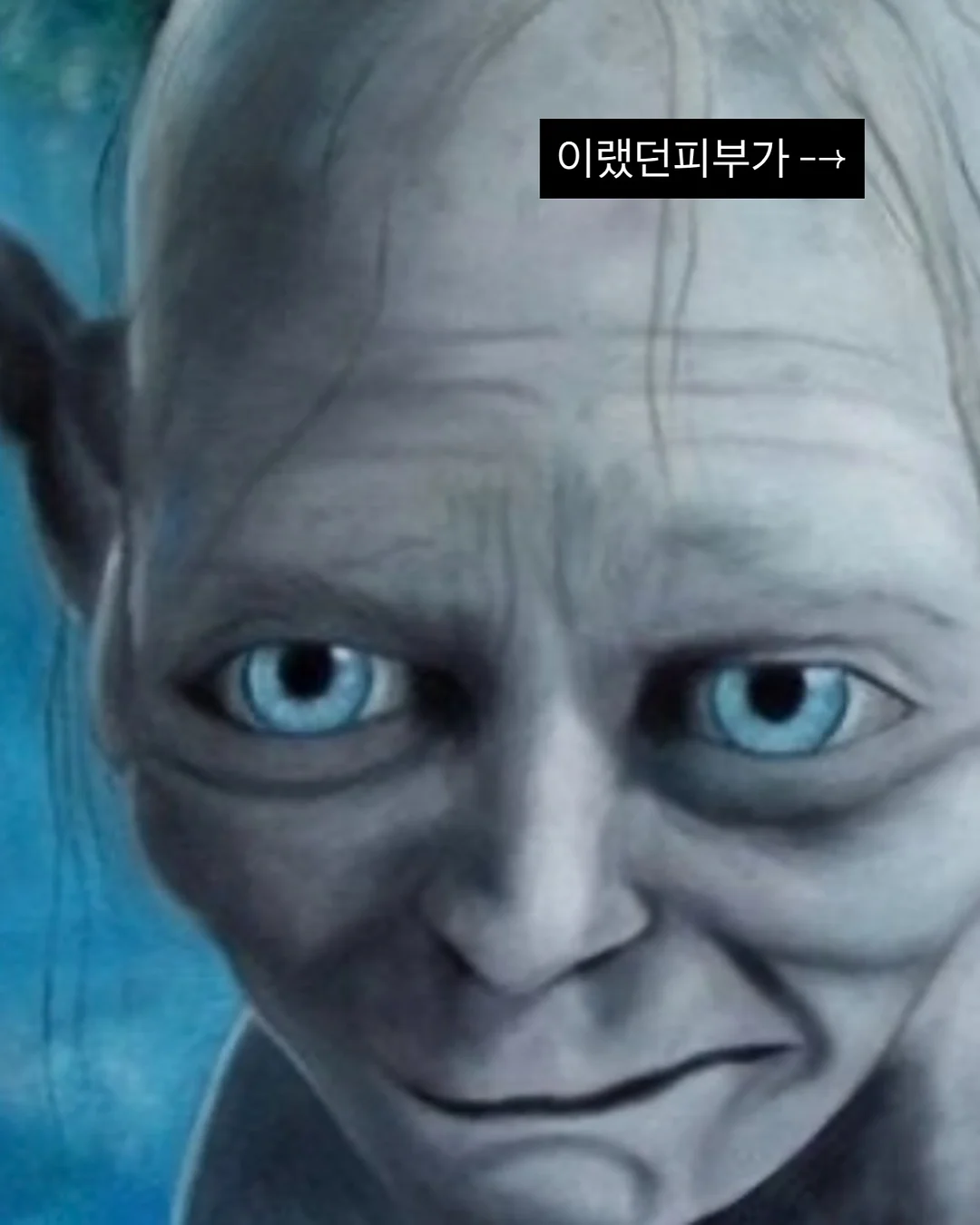 가슴성형 비용 3