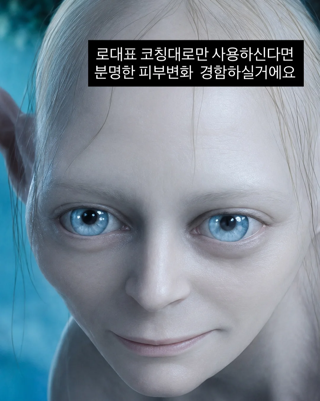 가슴성형 비용 4