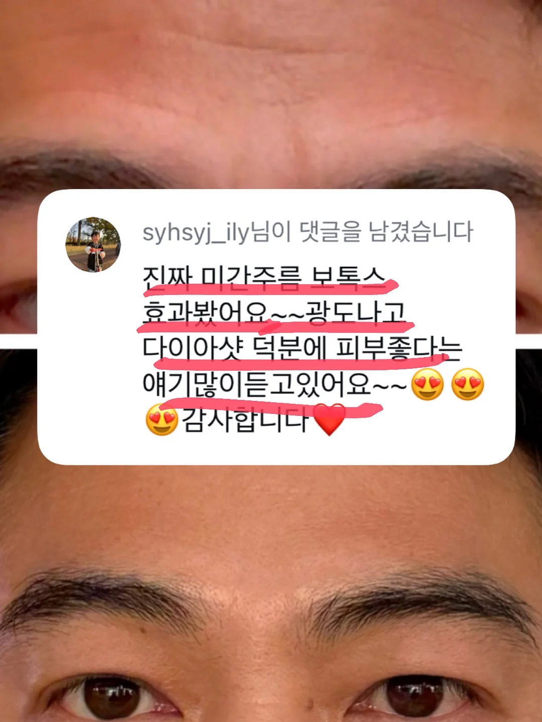 지지 네일아트 3
