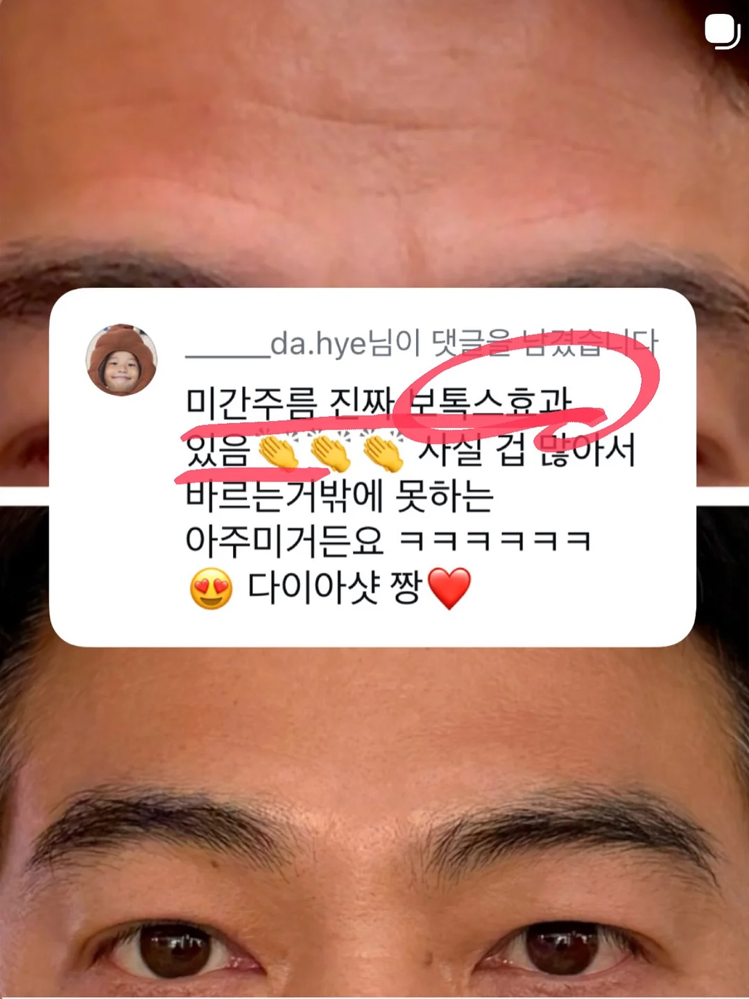 지지 네일아트 6
