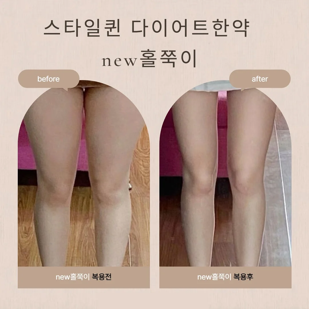 치트키 블라우스 2