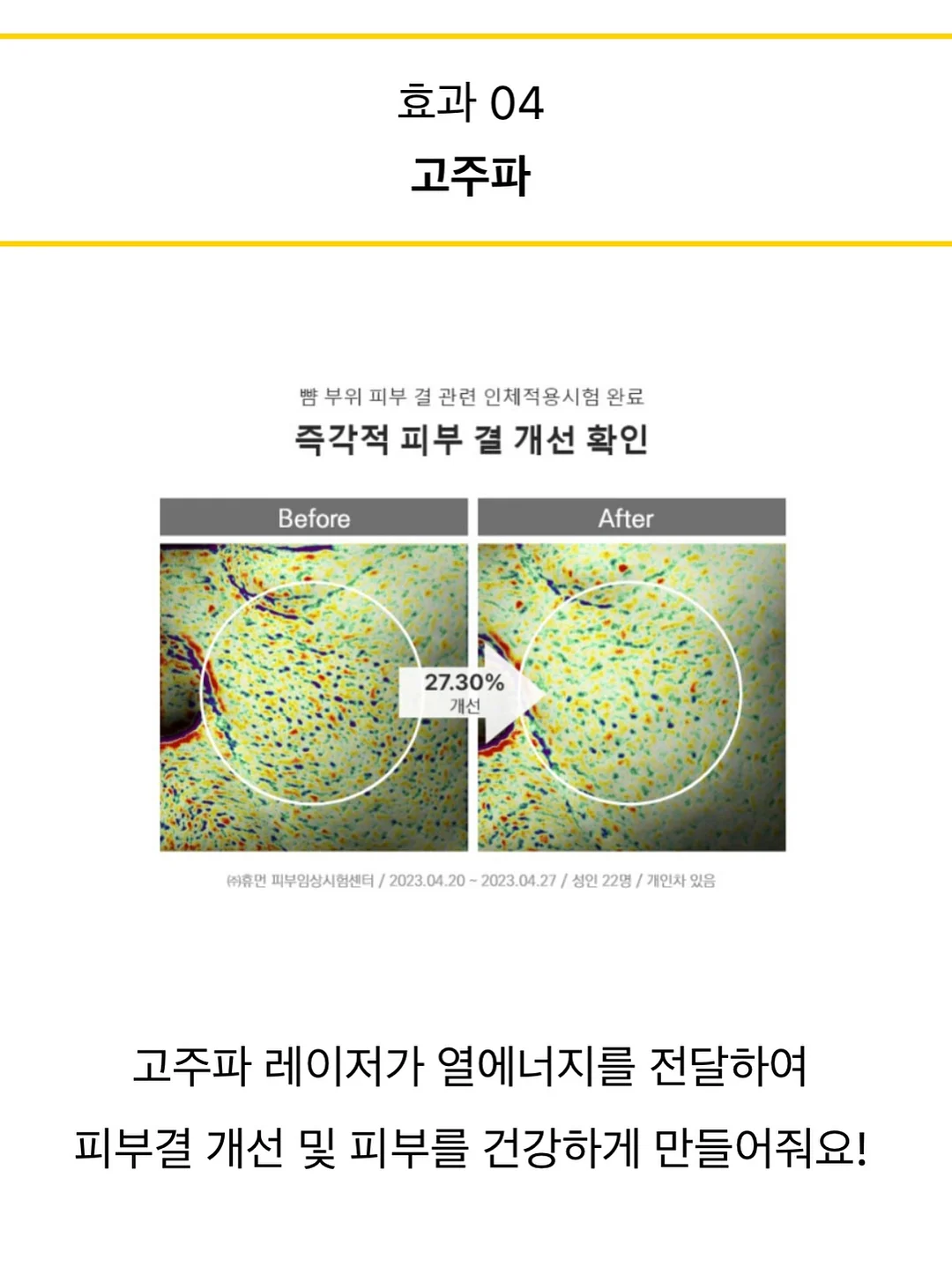 앙금플라워 생화 믹스디자인 케이크 9