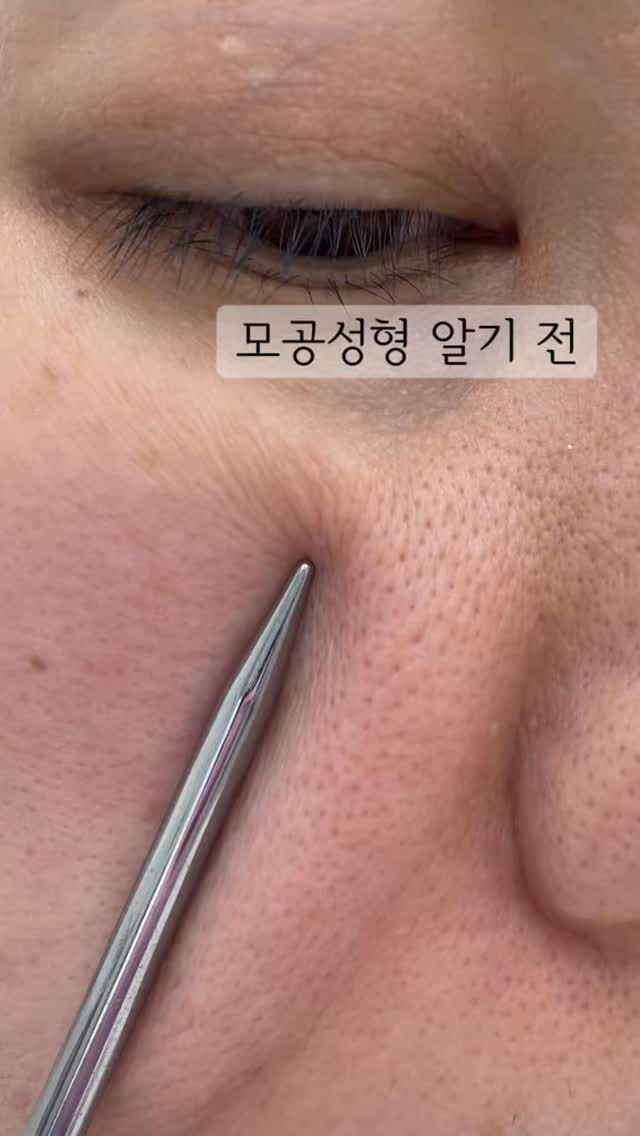 프레이포잇 얼룩제거제