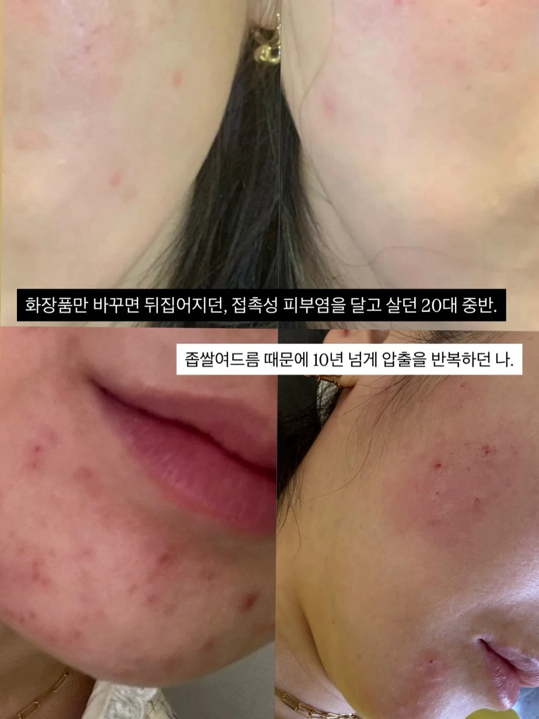 SMT척추교정임상전문가A&B통합과정 3