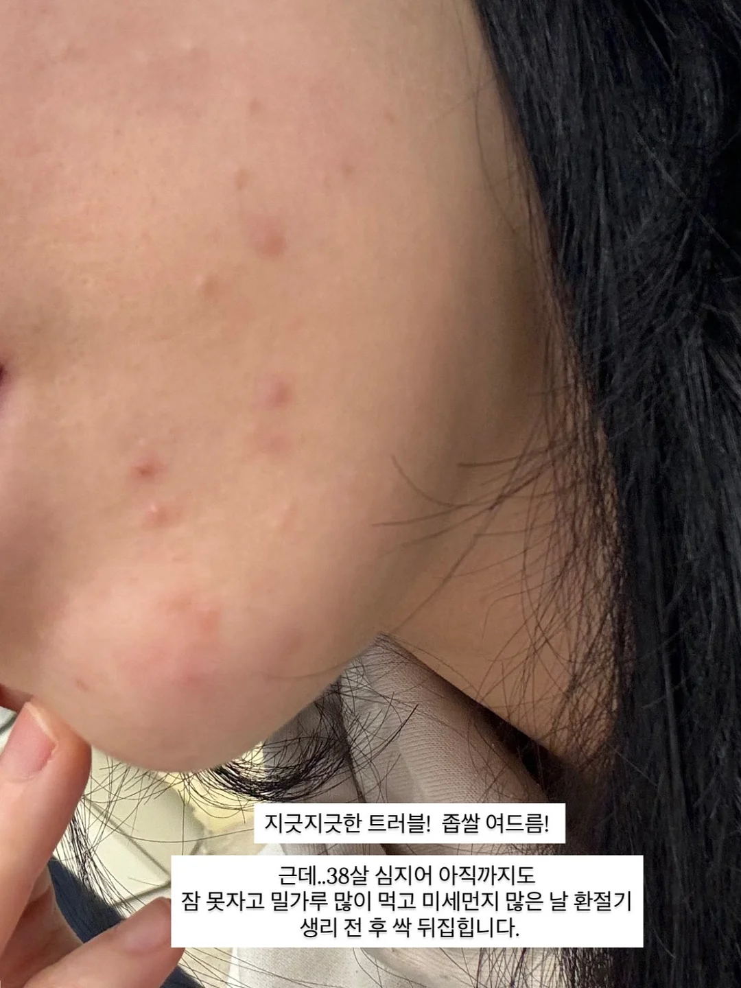 SMT척추교정임상전문가A&B통합과정 4