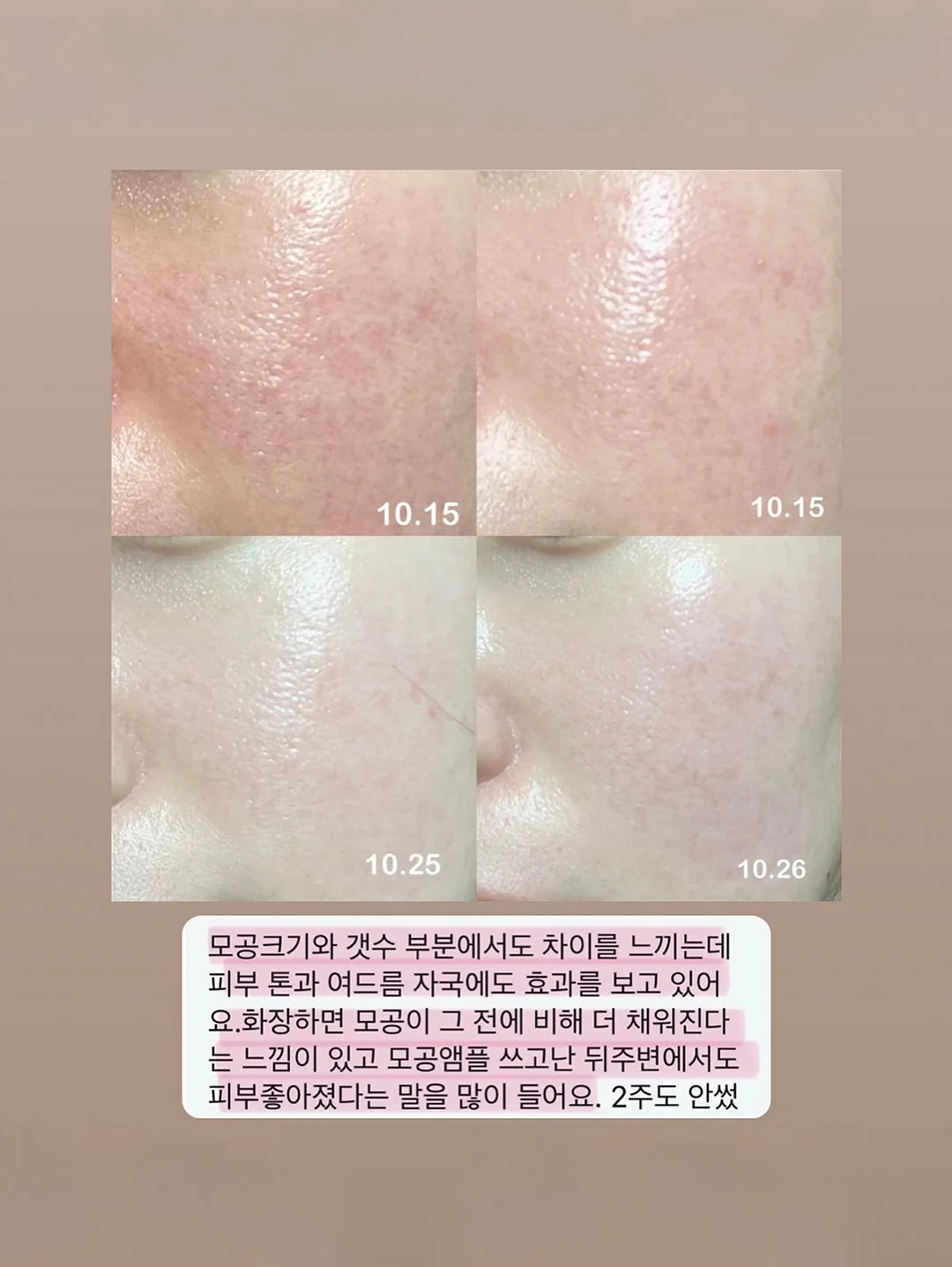 수전 15