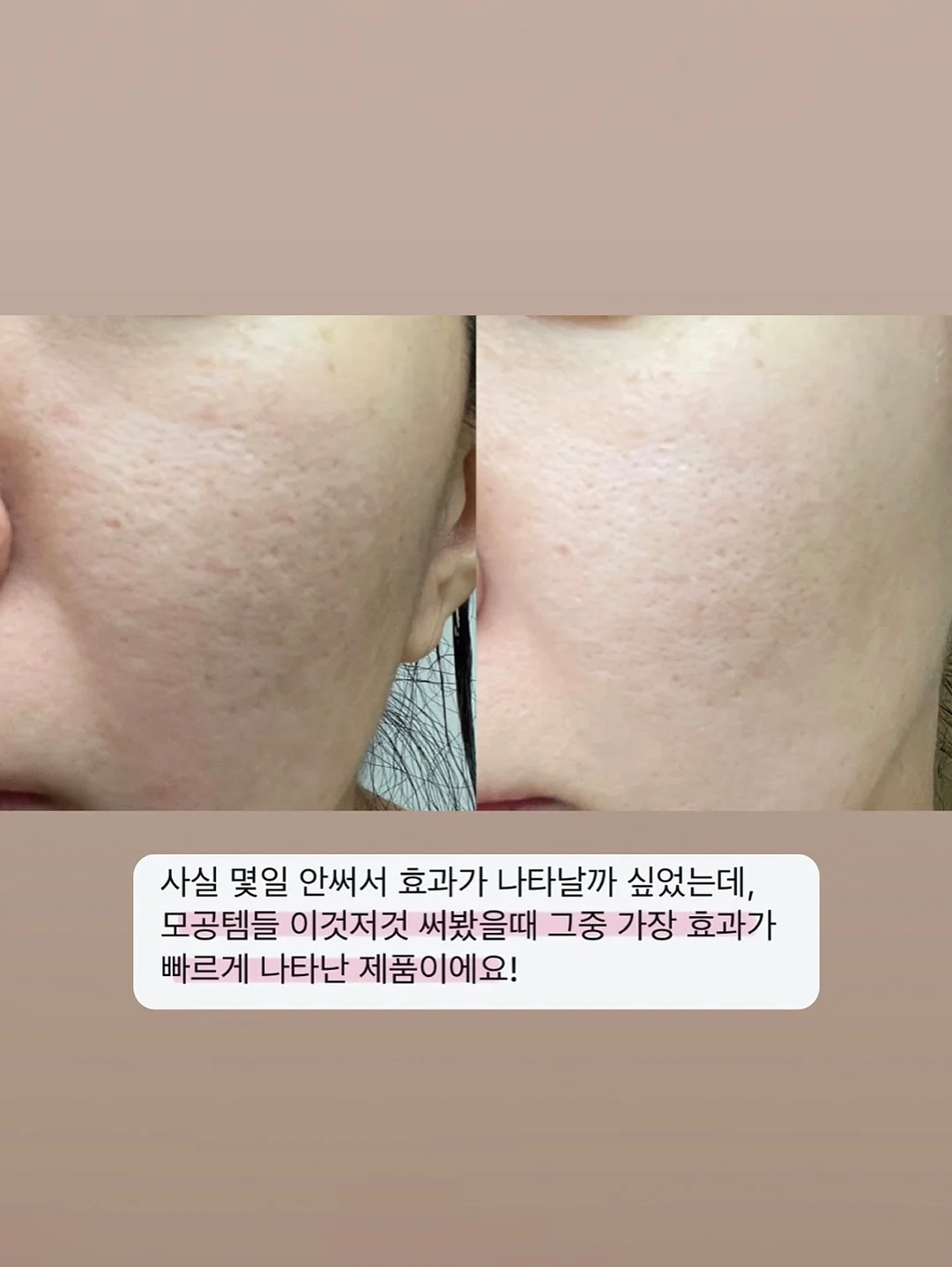 수전 17