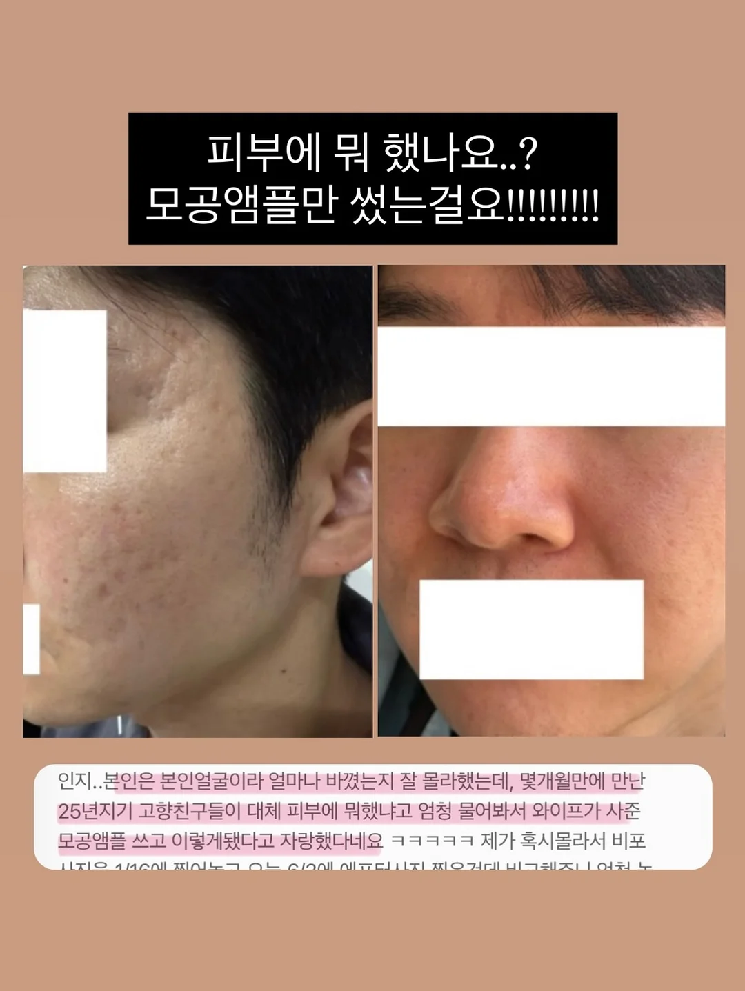 수전 5