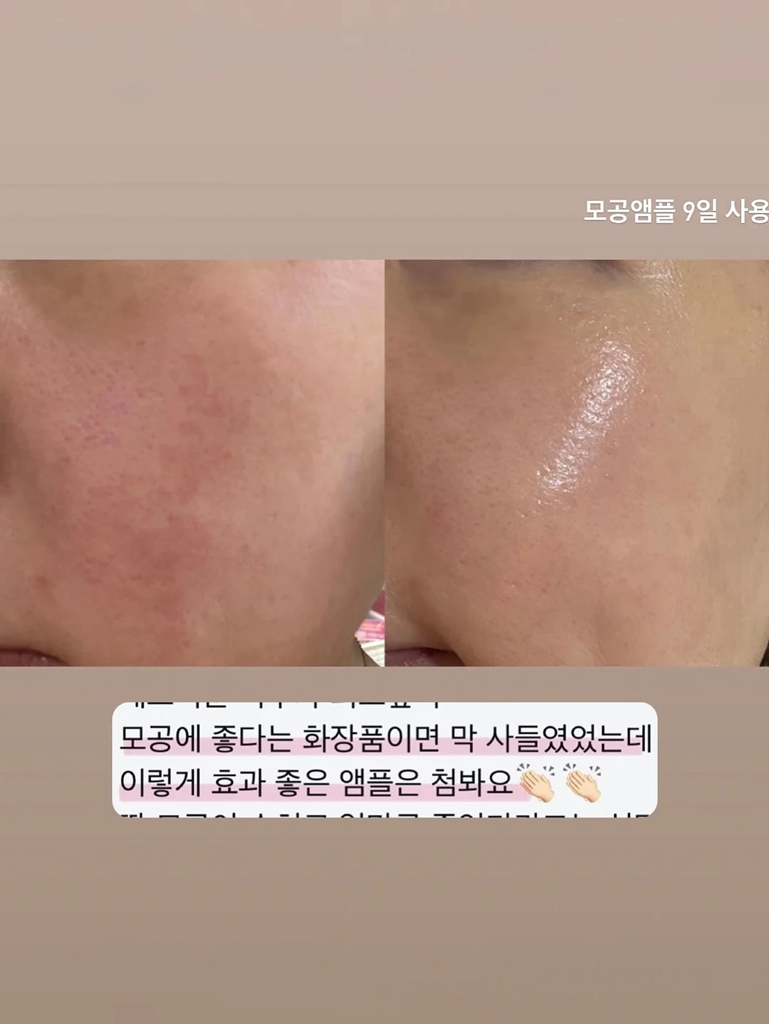 수전 10