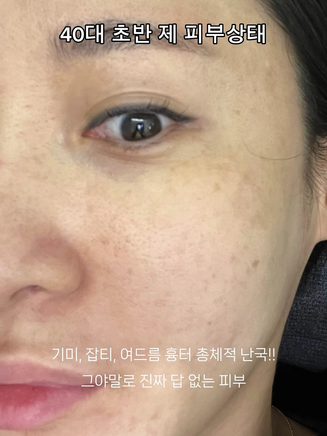 숏원피스 8