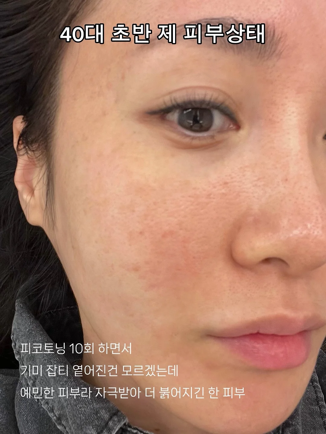 숏원피스 9