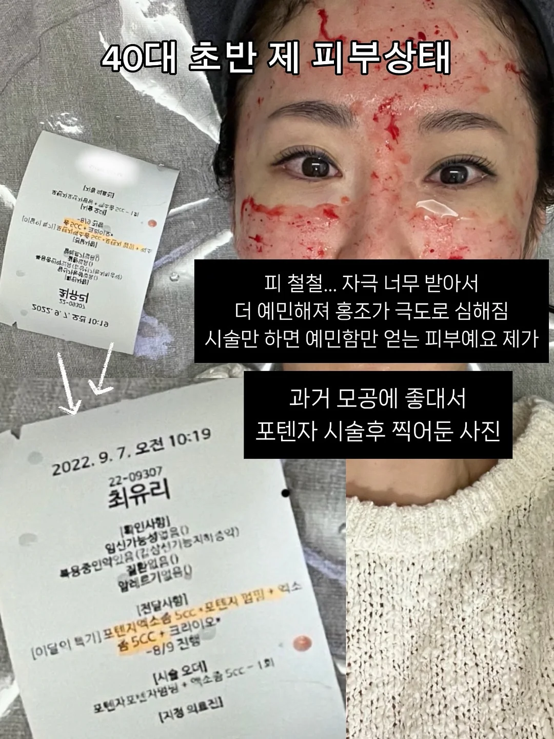 숏원피스 10