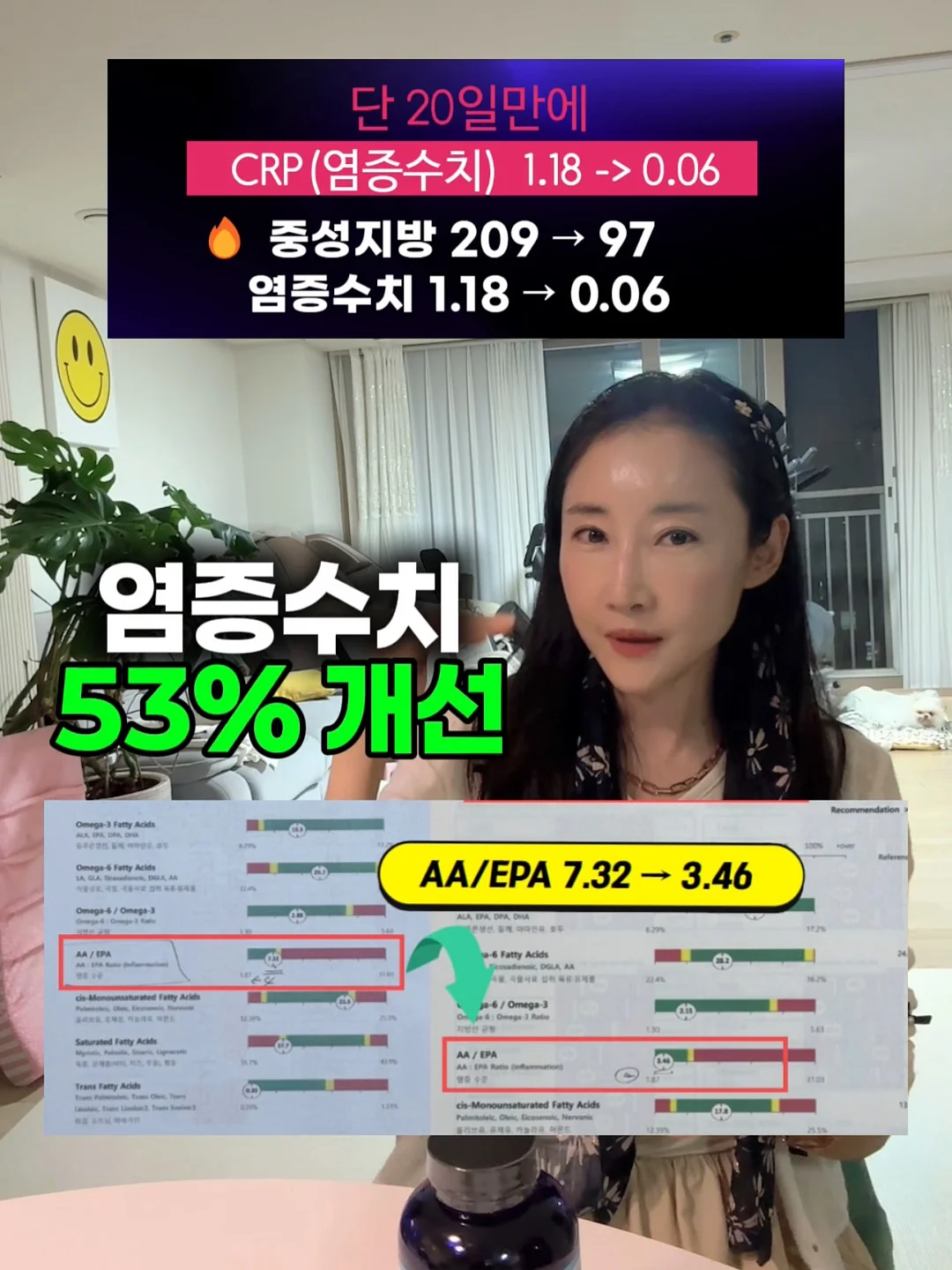 포어64 패키지 1
