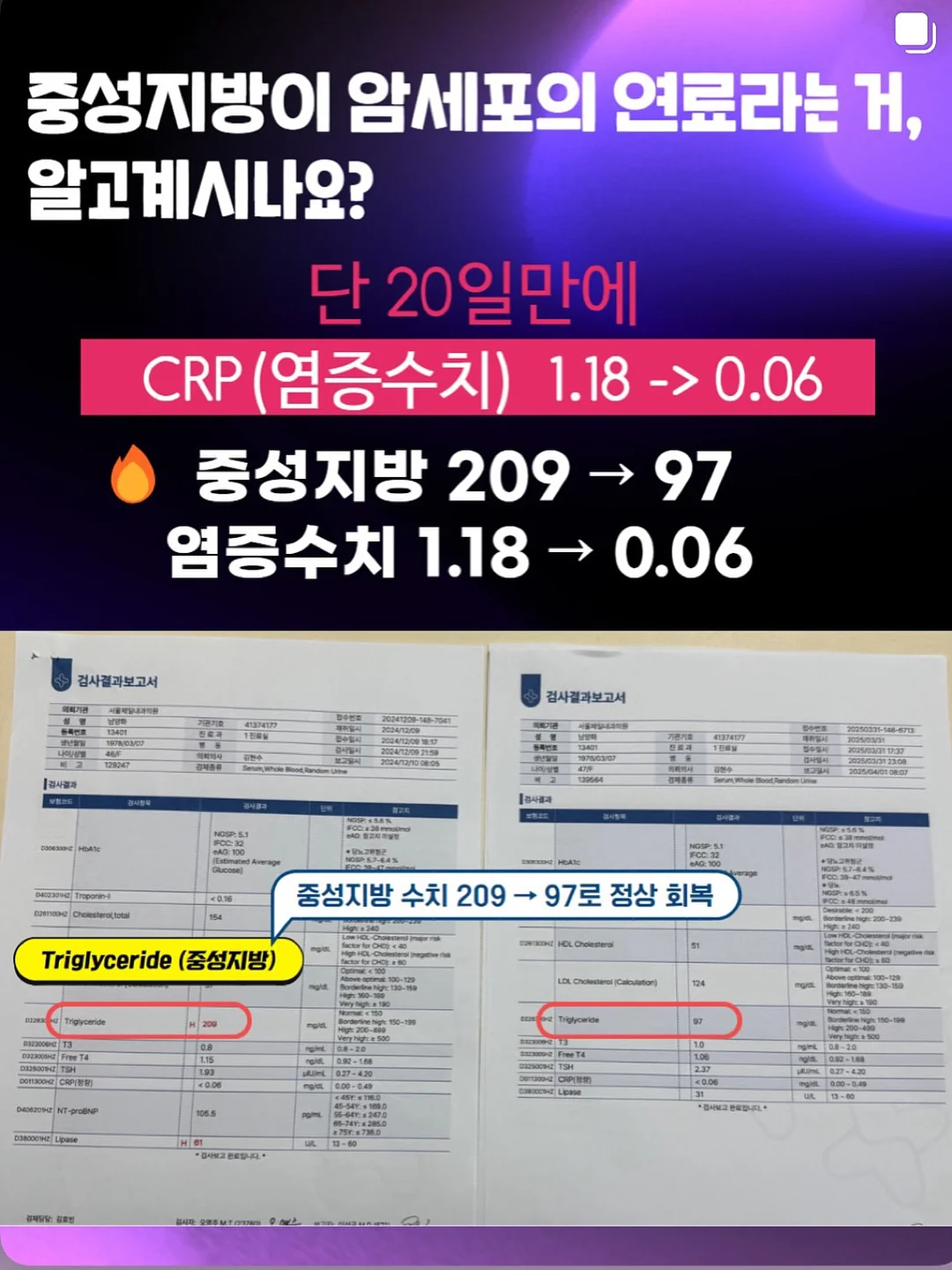 포어64 패키지 2