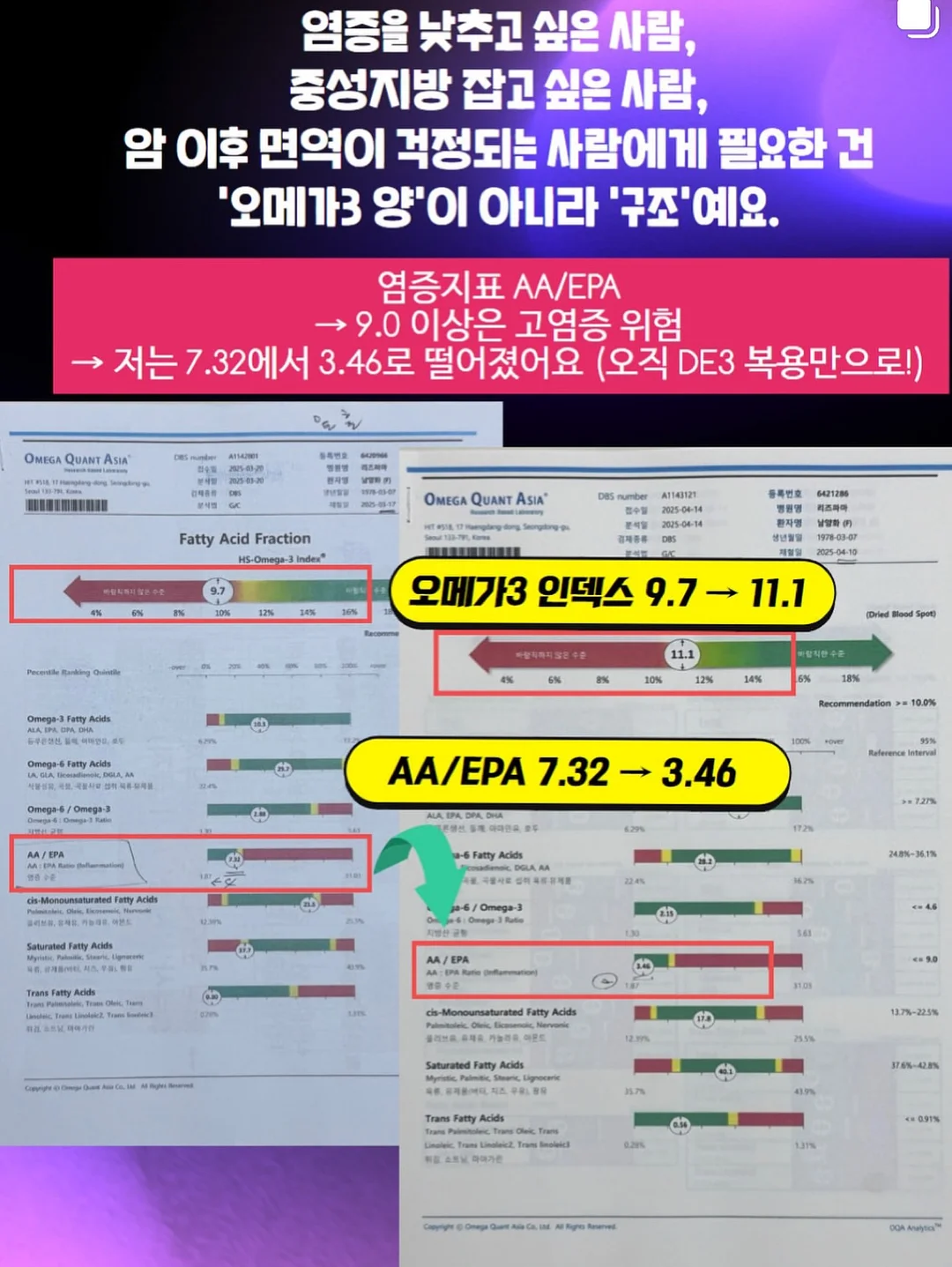 포어64 패키지 4