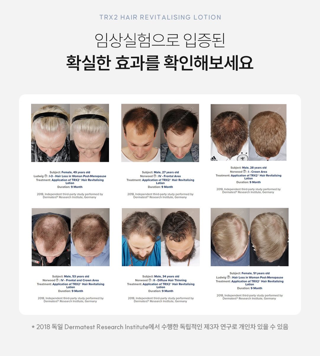 스피도 키즈 물안경 5