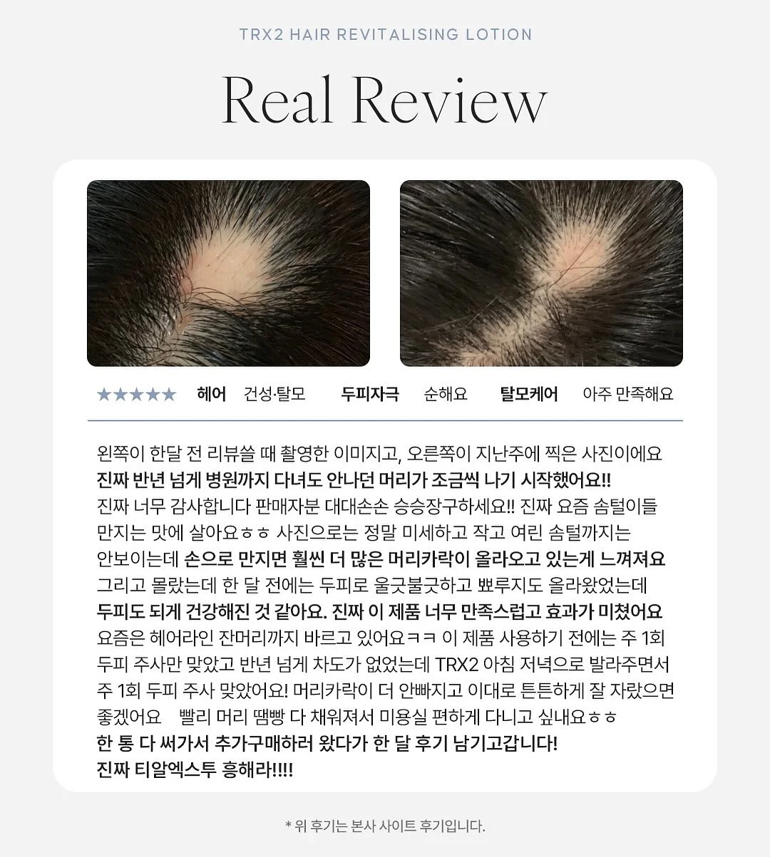 스피도 키즈 물안경 6