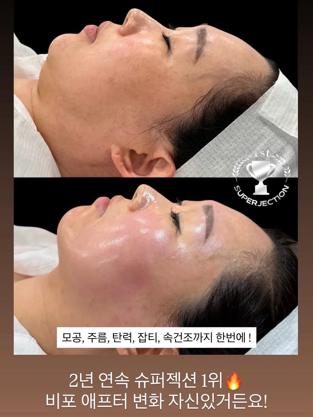 슬러시 기계 8
