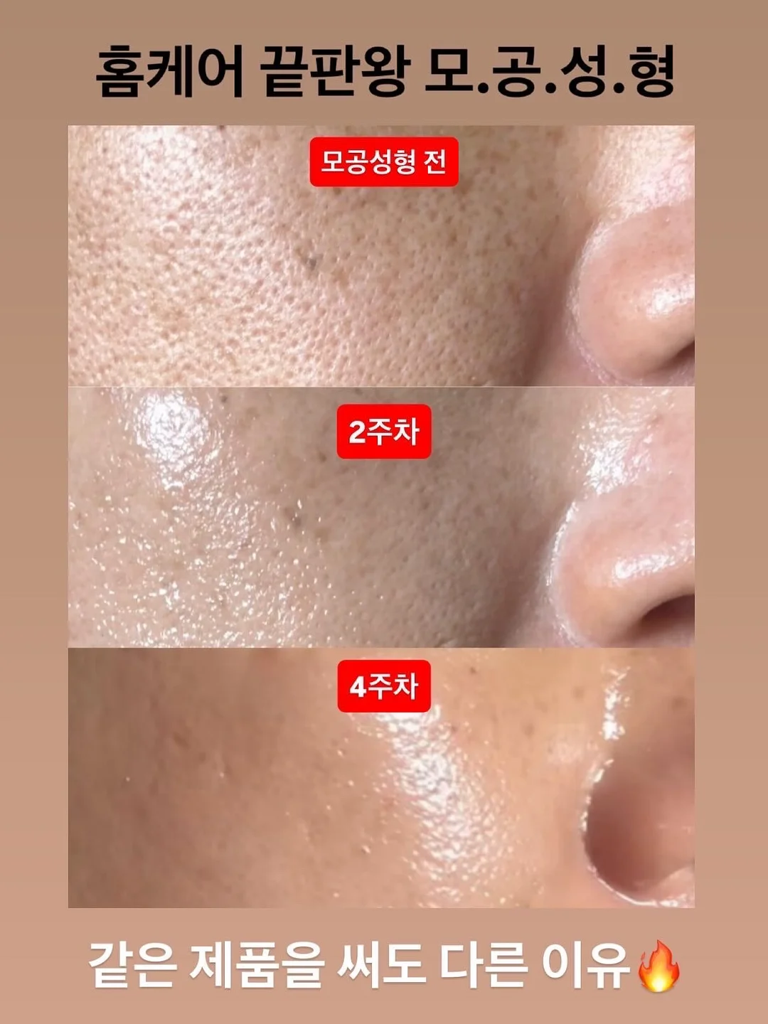 슬러시 기계 10