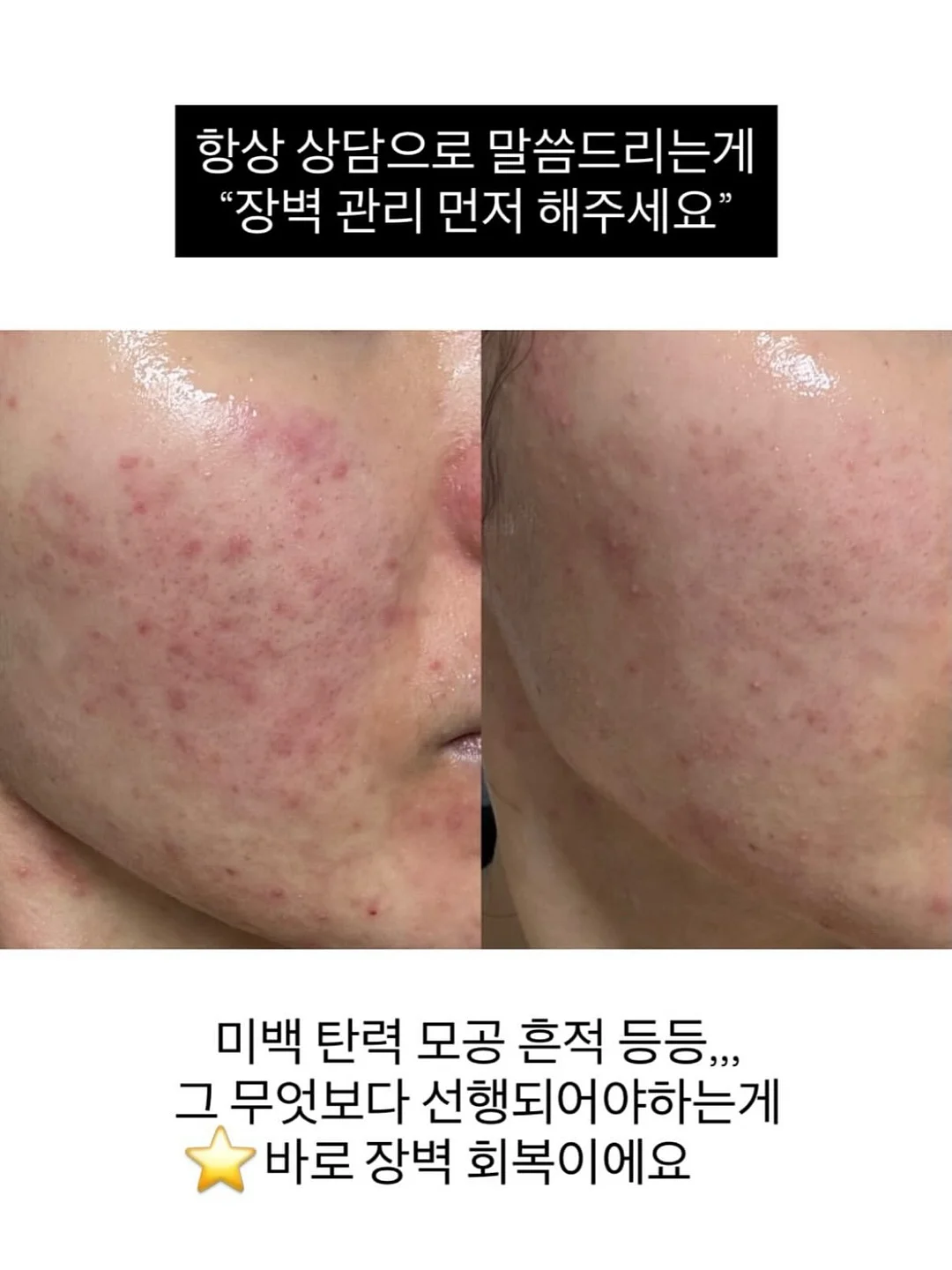 KYPG 학술스터디 14