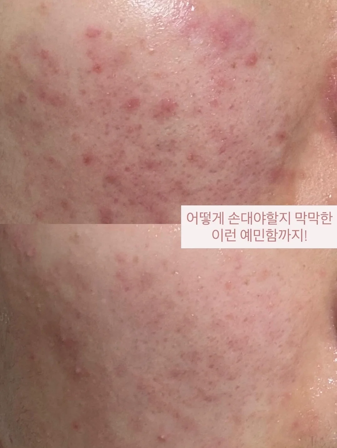 KYPG 학술스터디 17