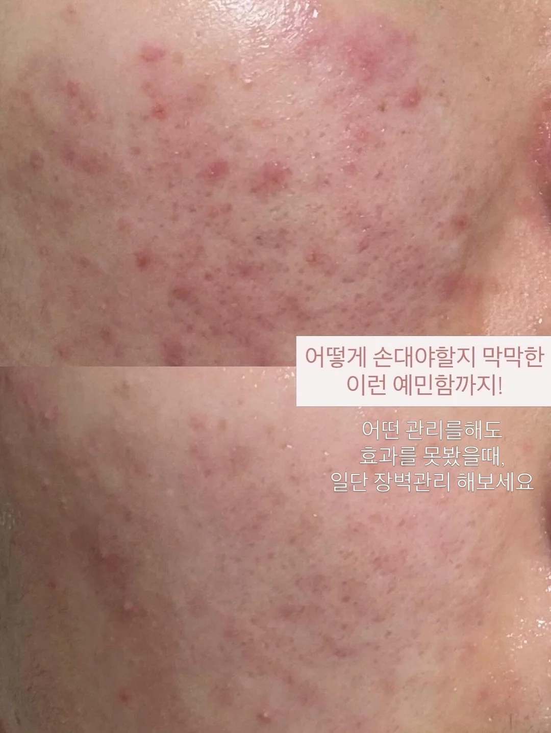 KYPG 학술스터디 9