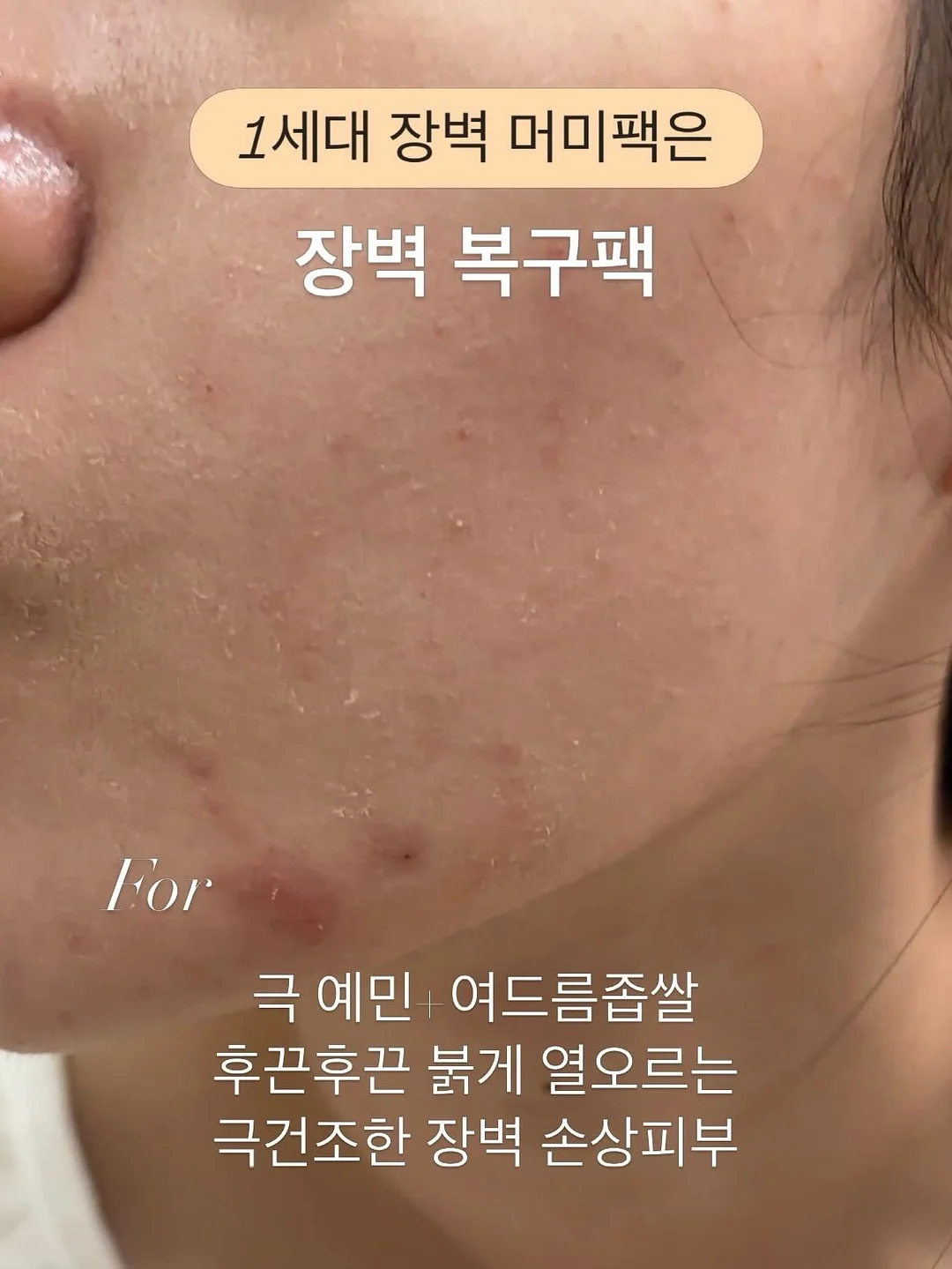 KYPG 학술스터디 10