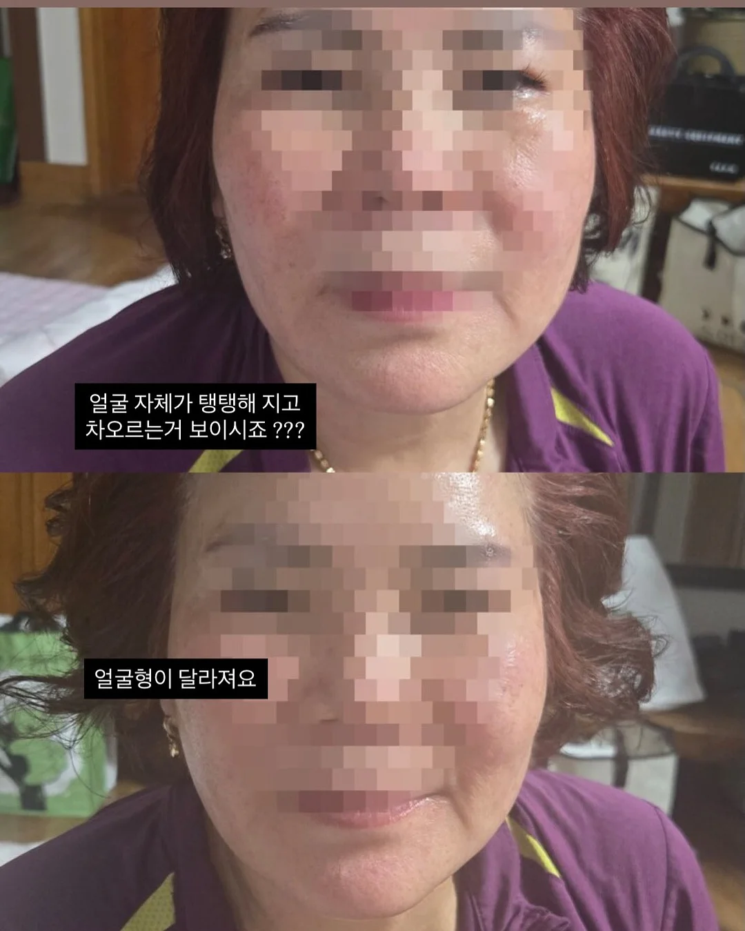 하루틴 리포좀 멀티비타민 4