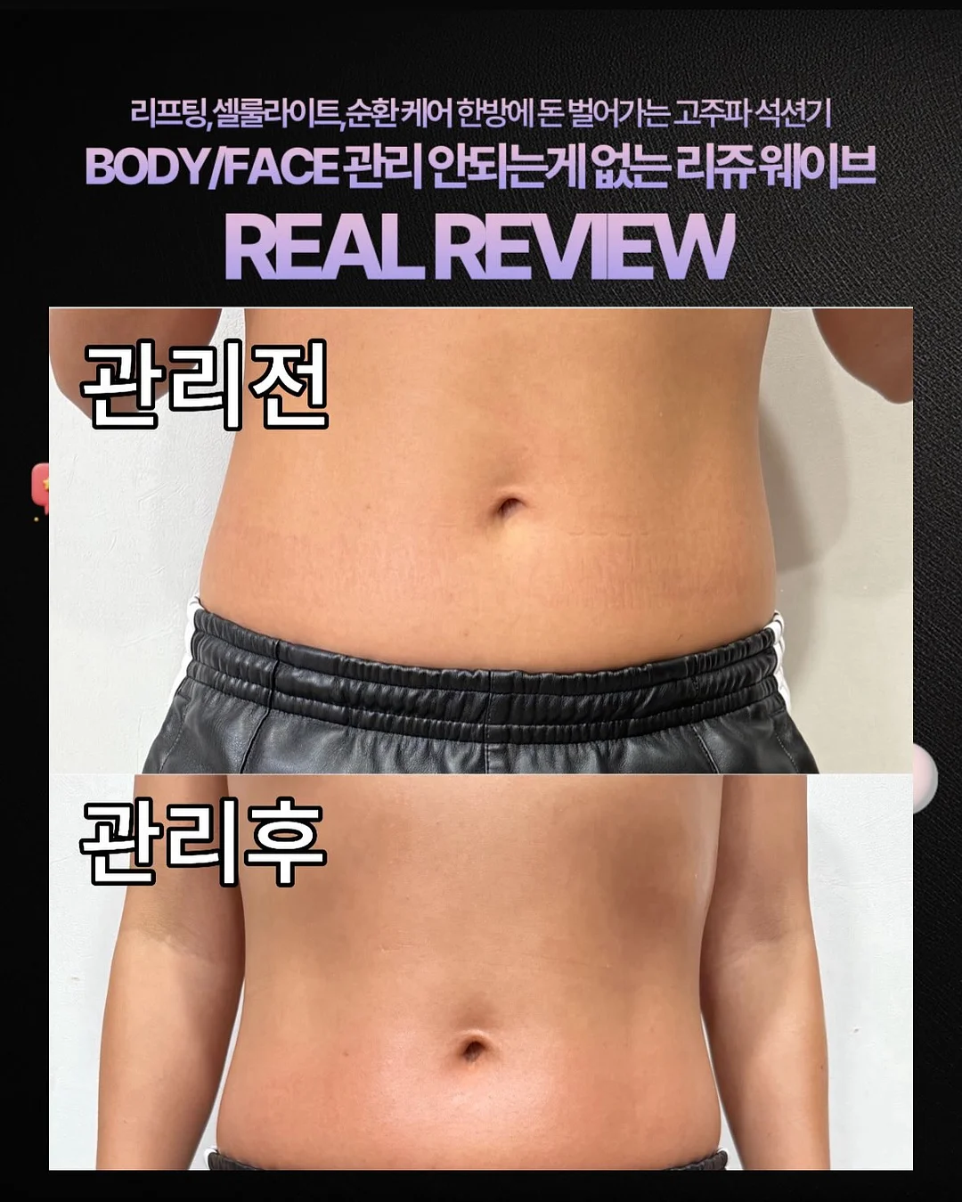 하루틴 리포좀 멀티비타민 7