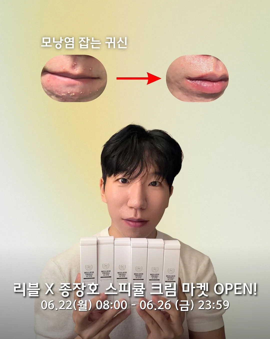 후드 1