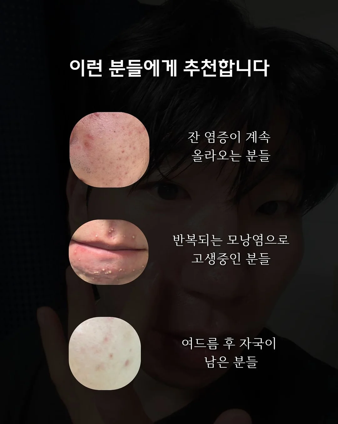 후드 4