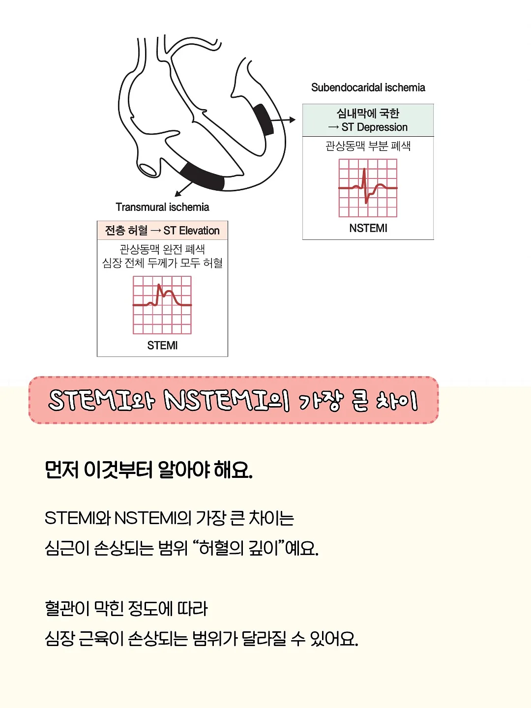 달항아리 화분 3