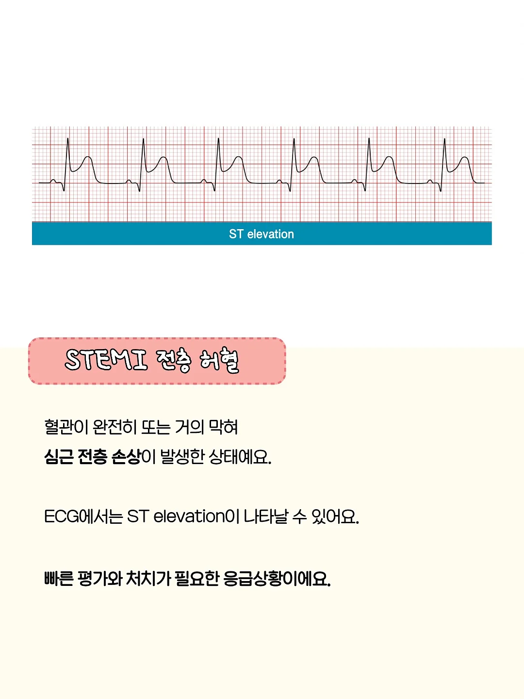 달항아리 화분 4