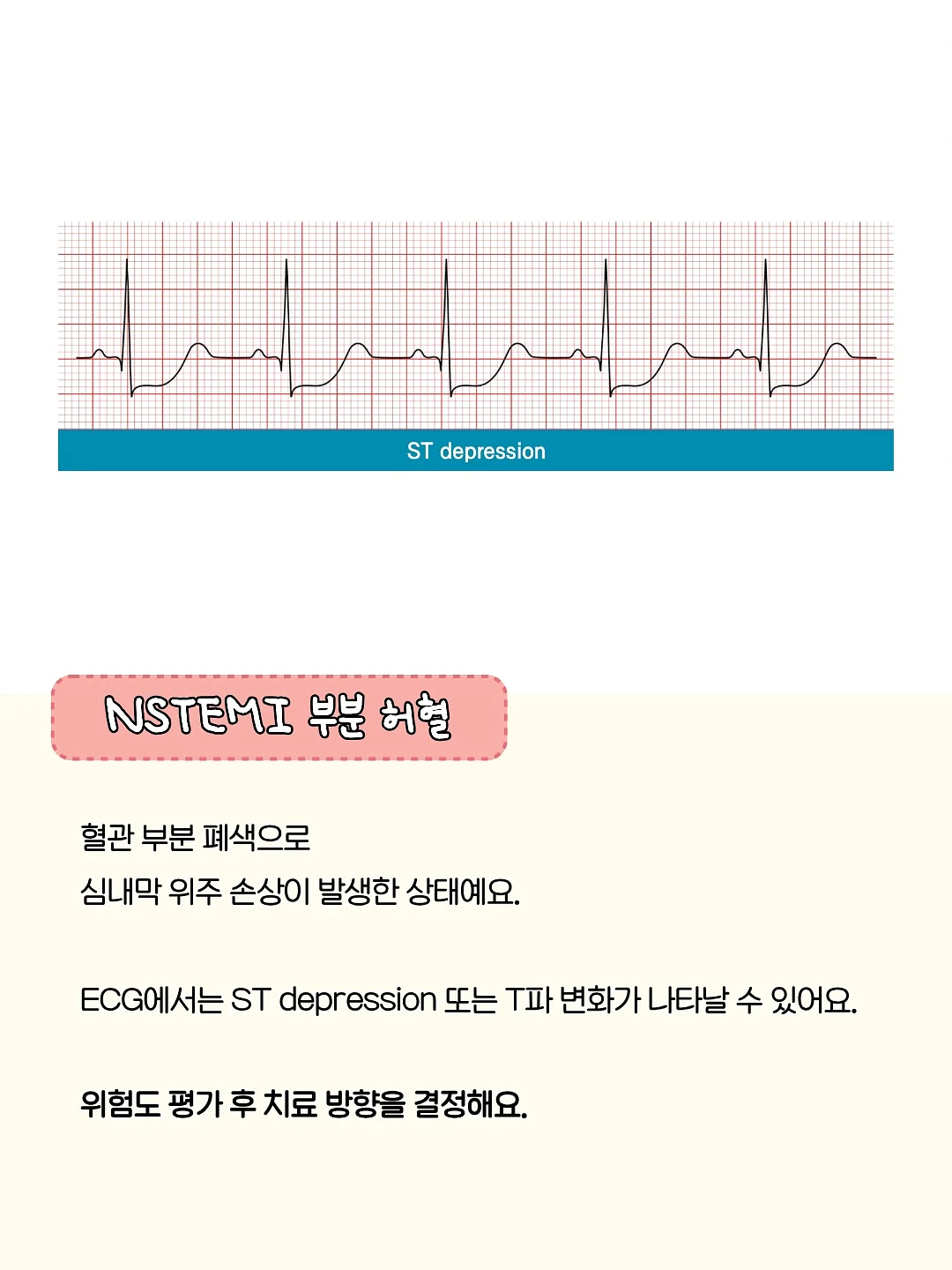 달항아리 화분 5